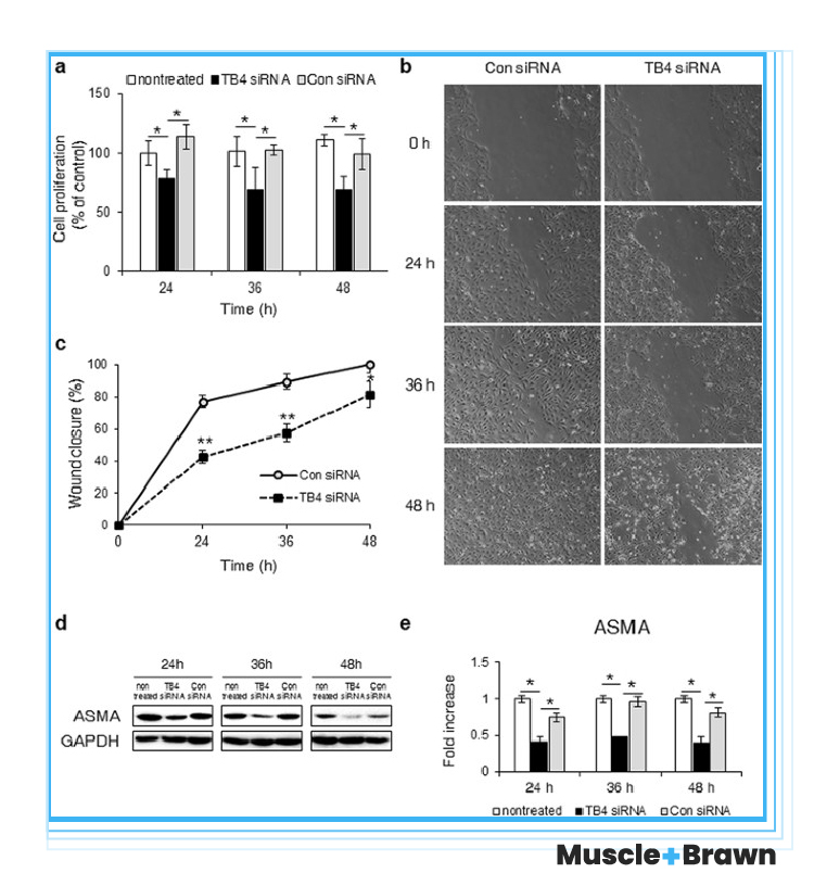 Effects of Thymosin Beta-4 on regeneration of Hepatic Stellate cells